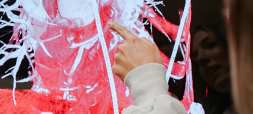 A student pointing to anatomy research on a screen.